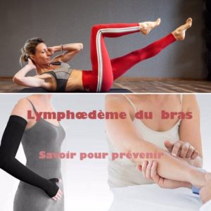 lymphoedeme et sport - Forme Service Grenoble
